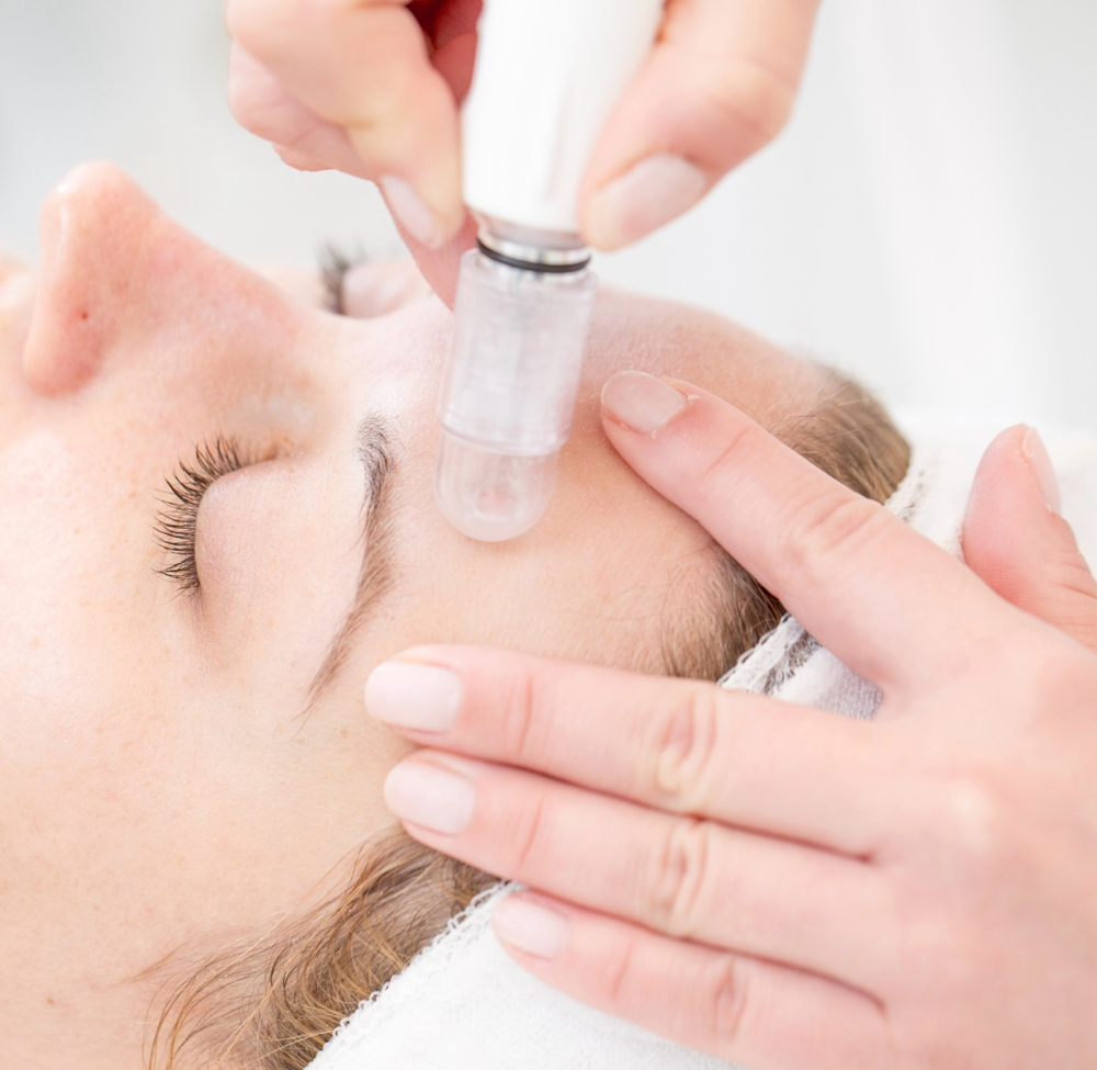 Add On Microdermabrasion