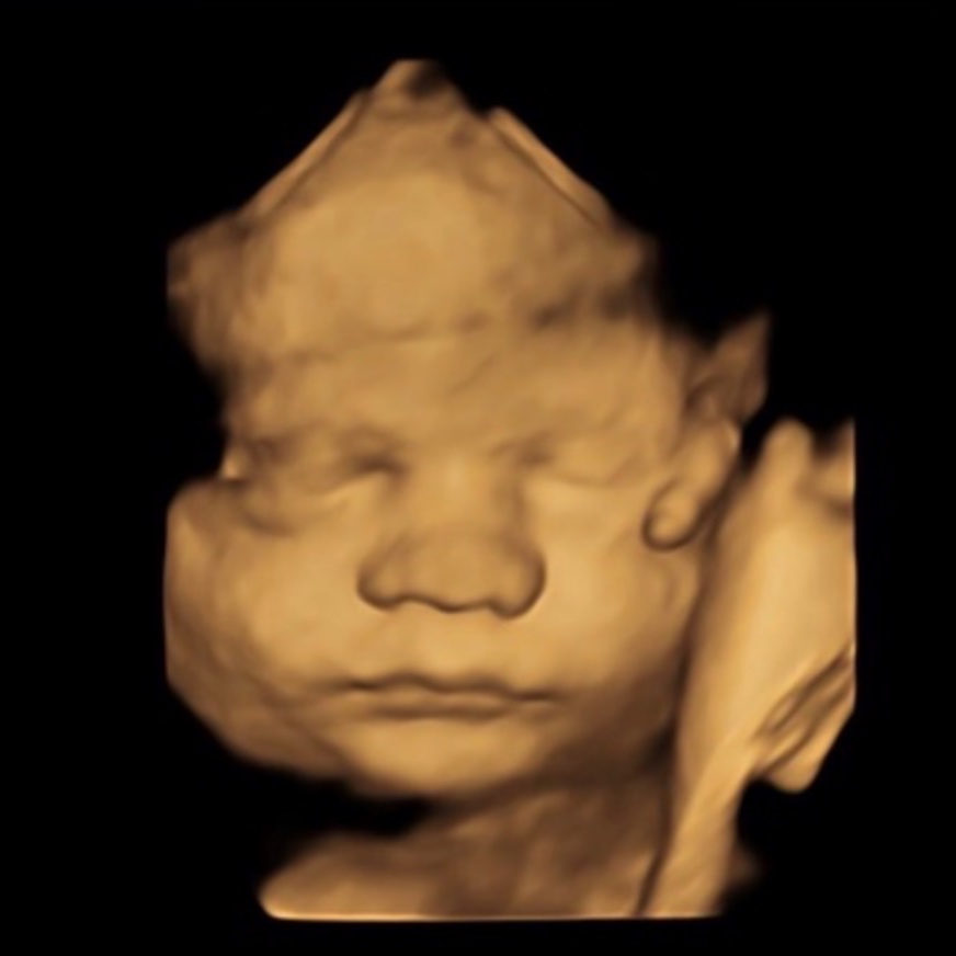 2D Quick Peek Reveal (15-39 Weeks) at Bump Studio  LLC in Rome, GA