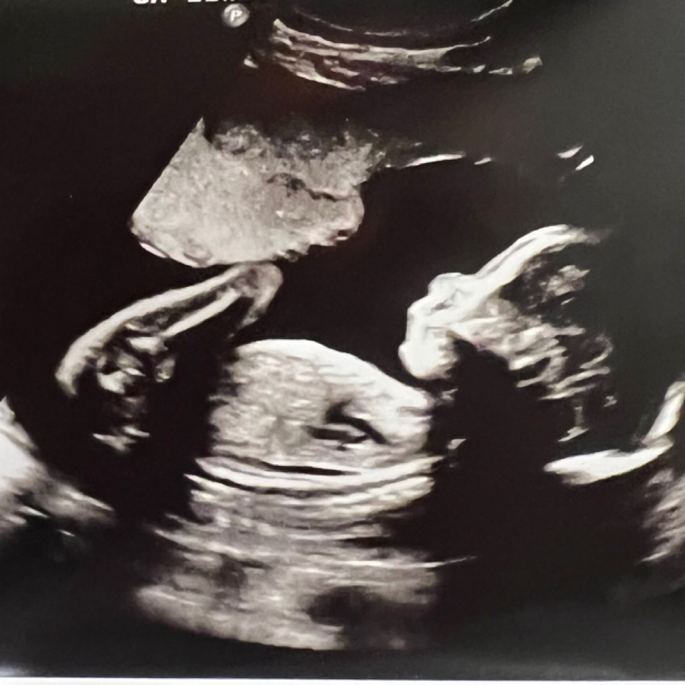 2D Quick Peek Reveal (15-39 Weeks) at Bump Studio  LLC in Rome, GA