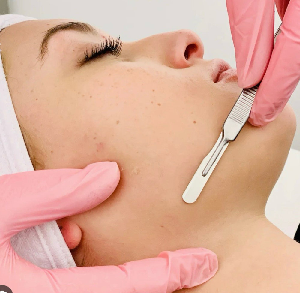 Dermaplane Mini at Skintique by lacey in Dayton, OH