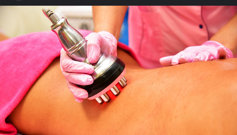 RF Skin Tightening