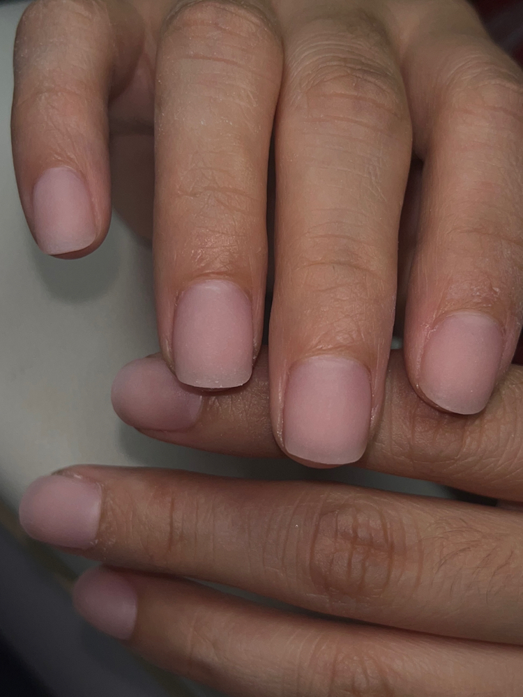 Acrylic Overlay