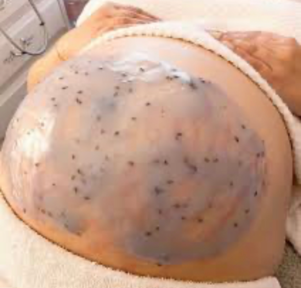 Pregnancy Belly Bump Facial