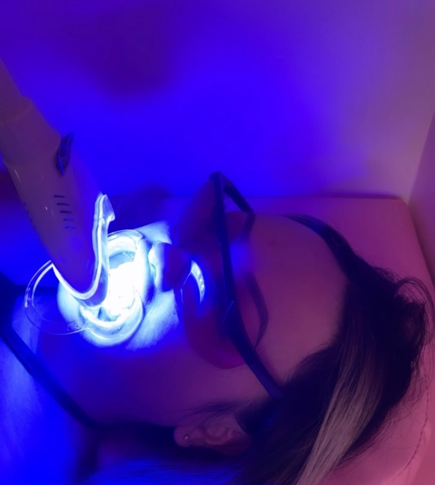 Teeth Whitening