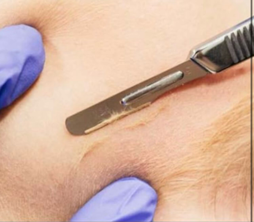 Dermaplane Add On