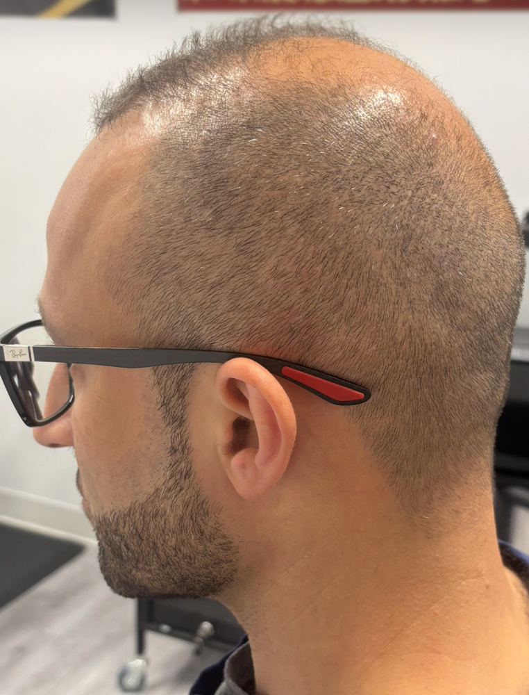 Neck Shave Clean Up