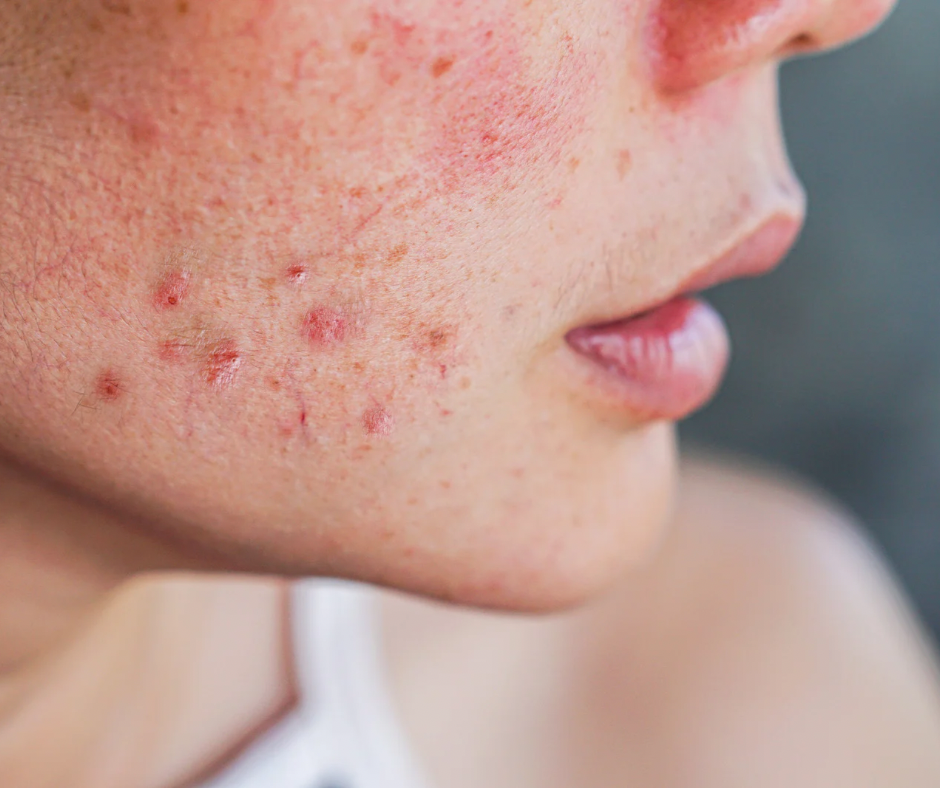 Bless Your Heart Facial at Well-Rooted Skincare in Hendersonville, NC