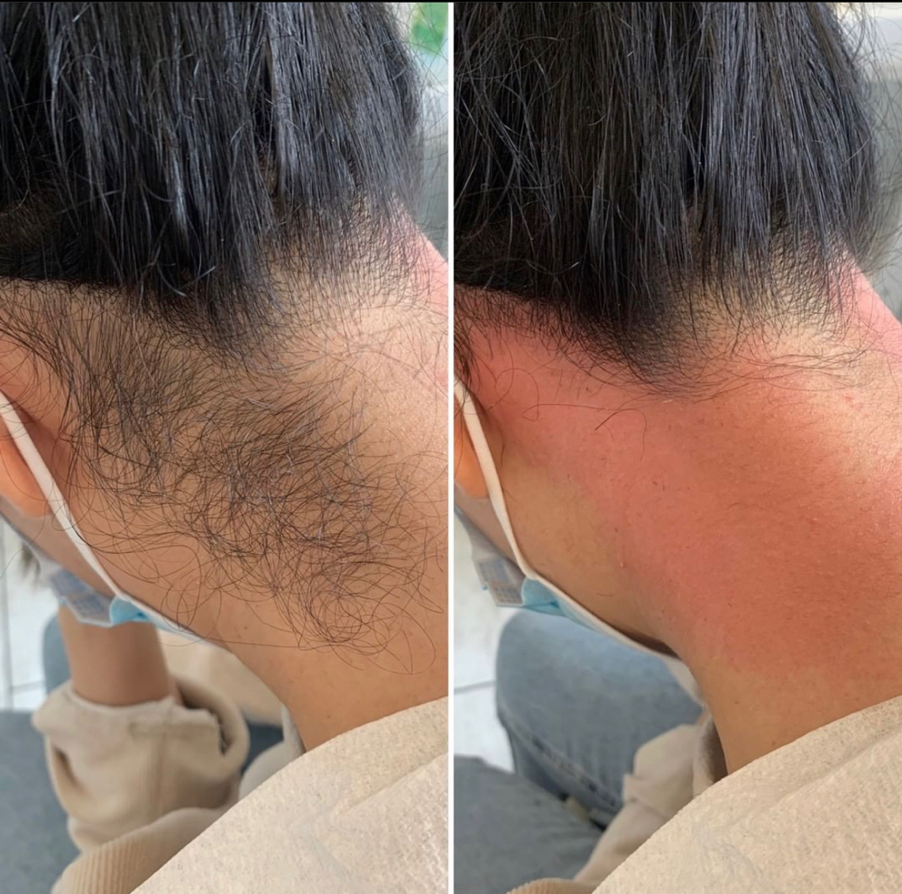 Hair Line Wax