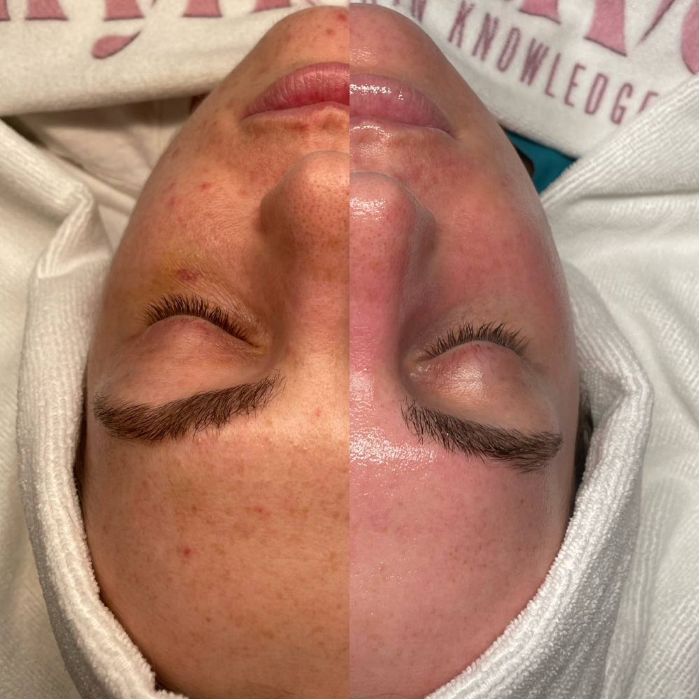 Ageless Facial