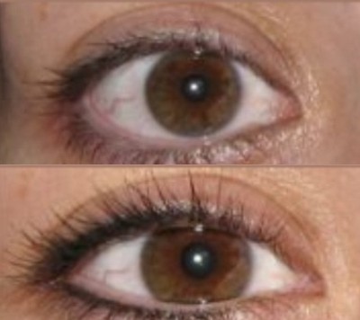Permanent Cosmetic Eyeliner