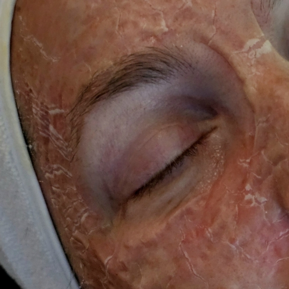 DMK Enzyme Facial at Beauty by Heather Niccole in Pataskala, OH