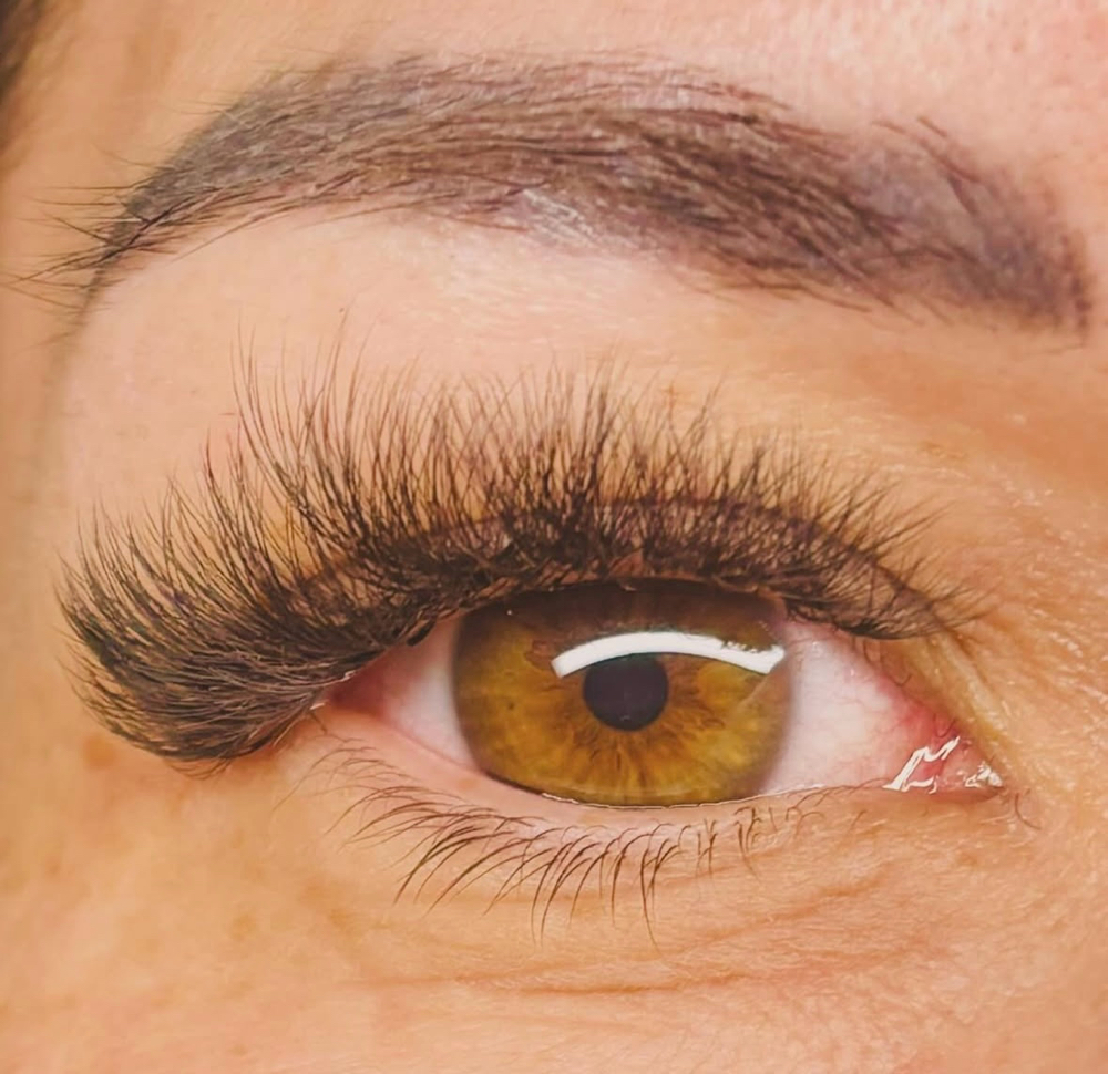 Consultation/ Patch test