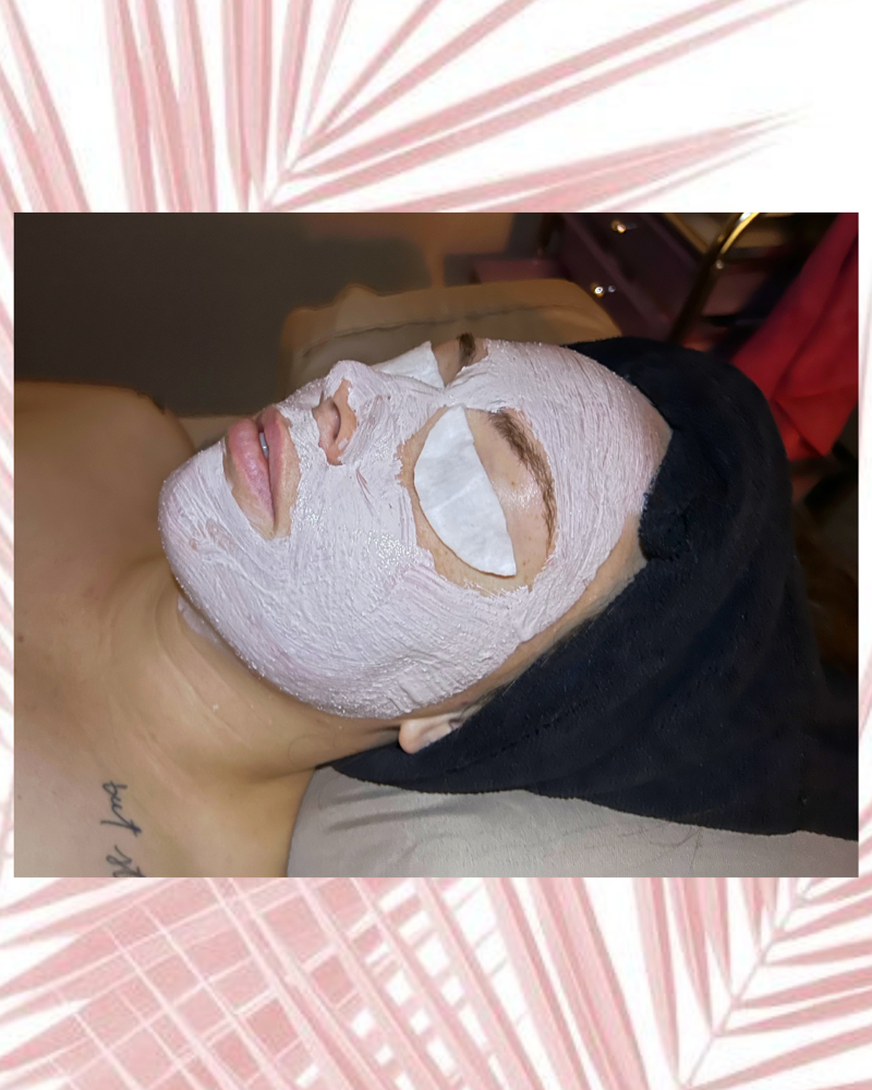 Acne Facial