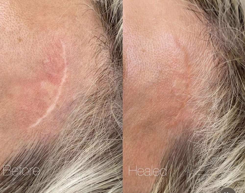 SCAR CAMOUFLAGE at NICHÉ in Lewisville, TX