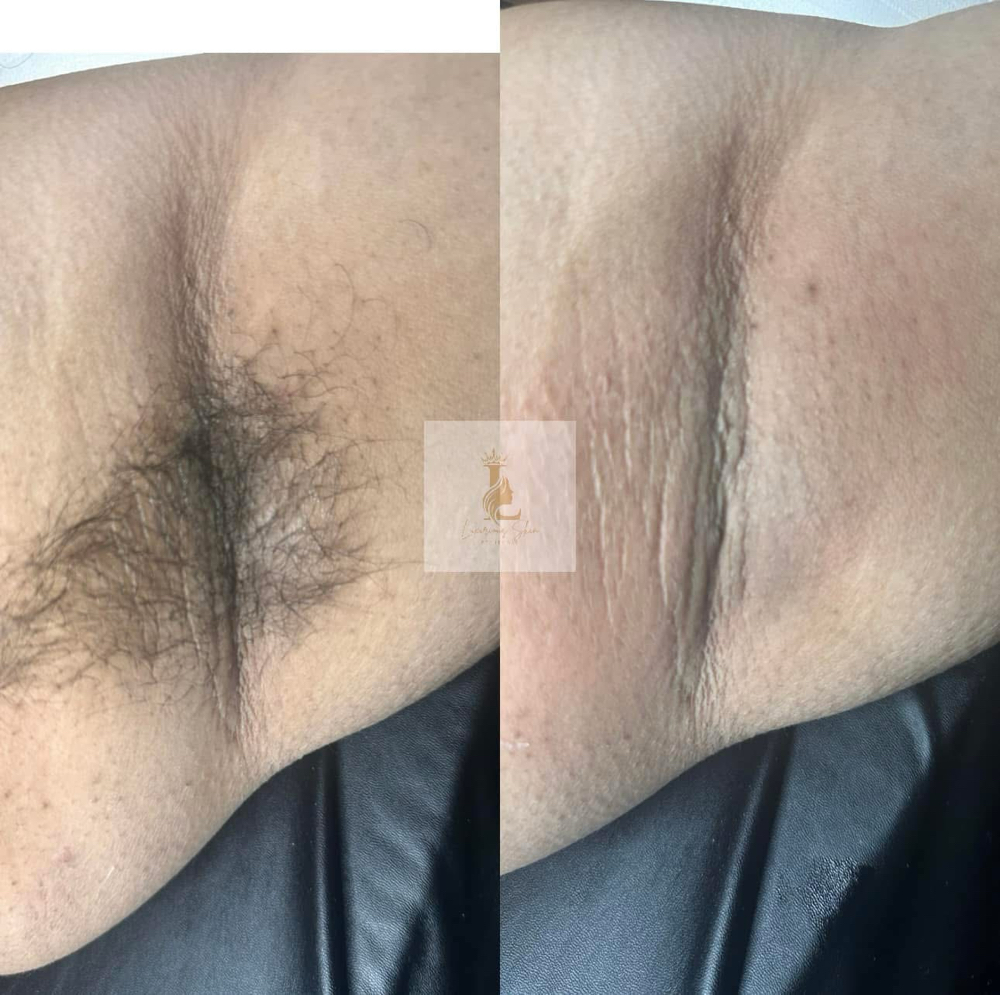 Underarm Wax at Luxurious Skin Beauty Bar in Memphis, TN