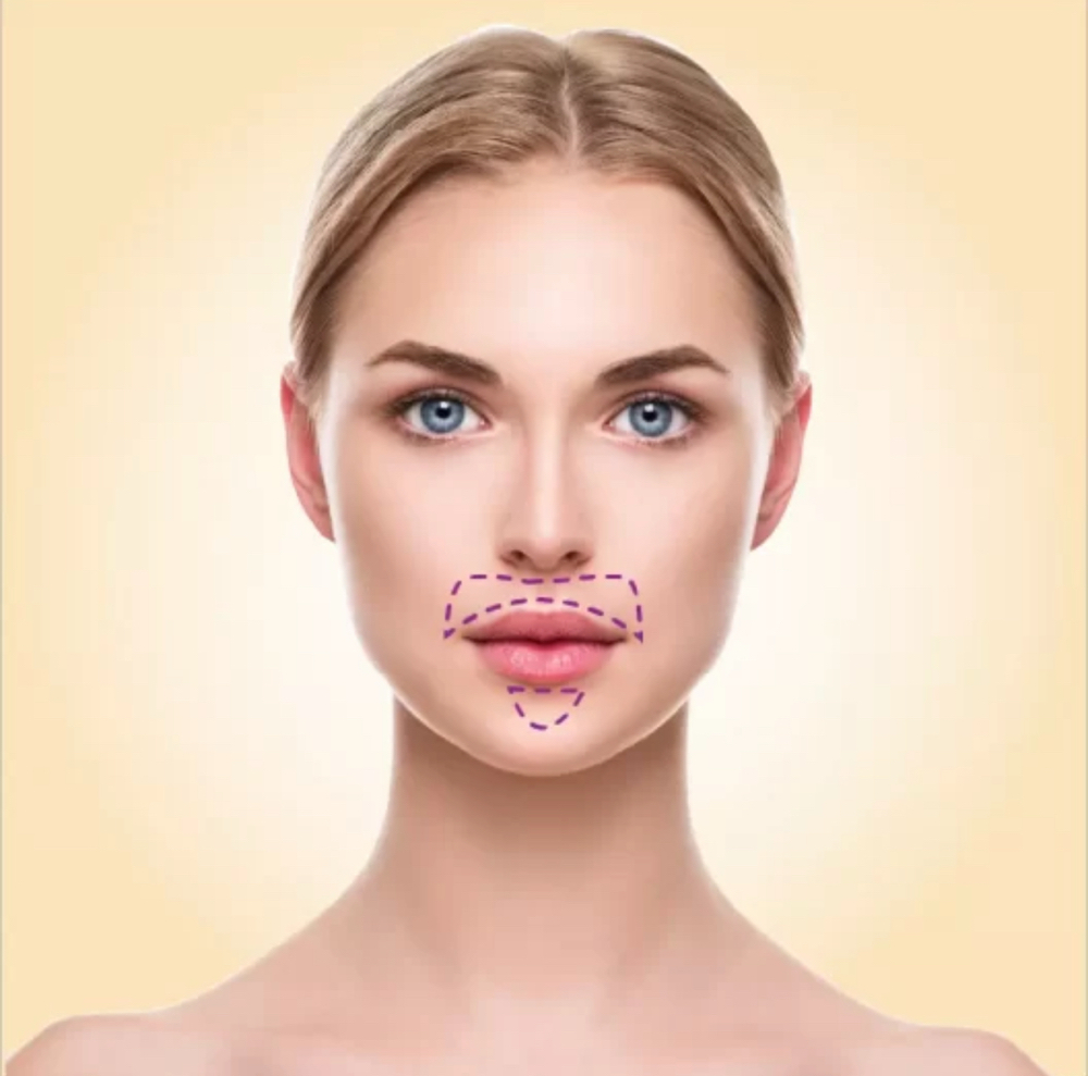 Upper Lips / Buço