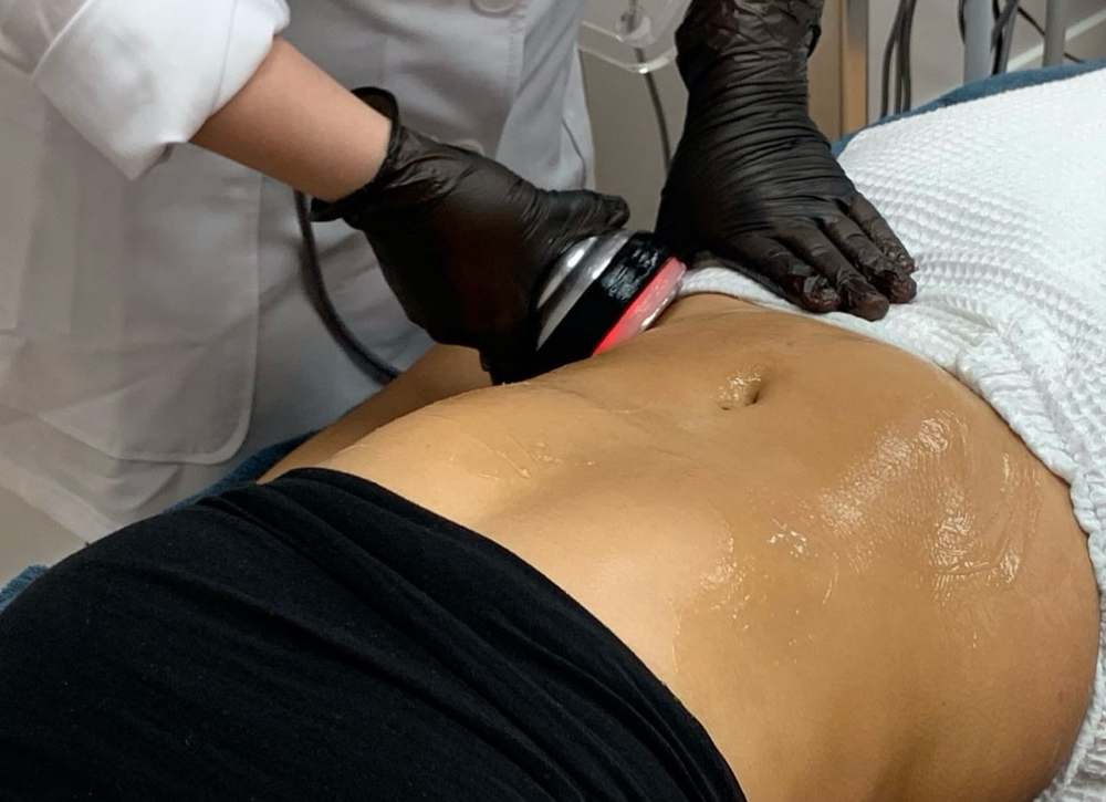 Cavitation + RF + Vacuum Therapy