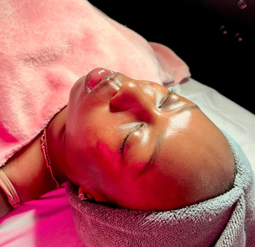 Epidermabrasion Facial