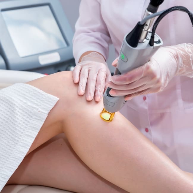 Laser Hair Removal