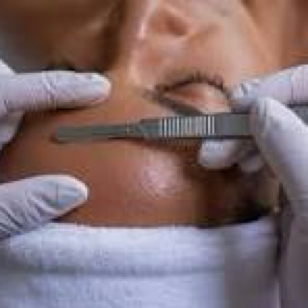 ADD-ONS: Dermaplaning at Skincare by Beth LLC in Winter Garden, FL