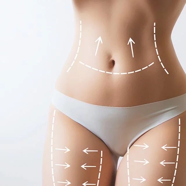 Body Contour