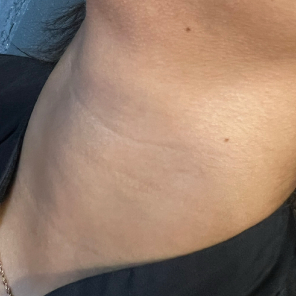 Neck Wax at The Bikini Bar By WaWa in Lagrange, GA