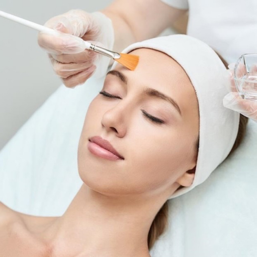 Radiance Refining Peel at SkinUpgradeMD in Charlotte, NC