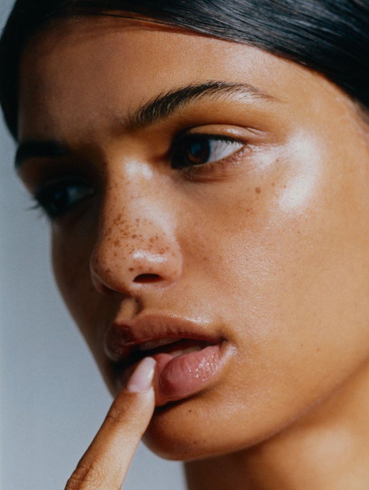 Sun Spot Removal Facial