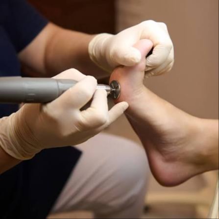 Add On Callus Treatment at Pure Nail Bar in Denver, CO