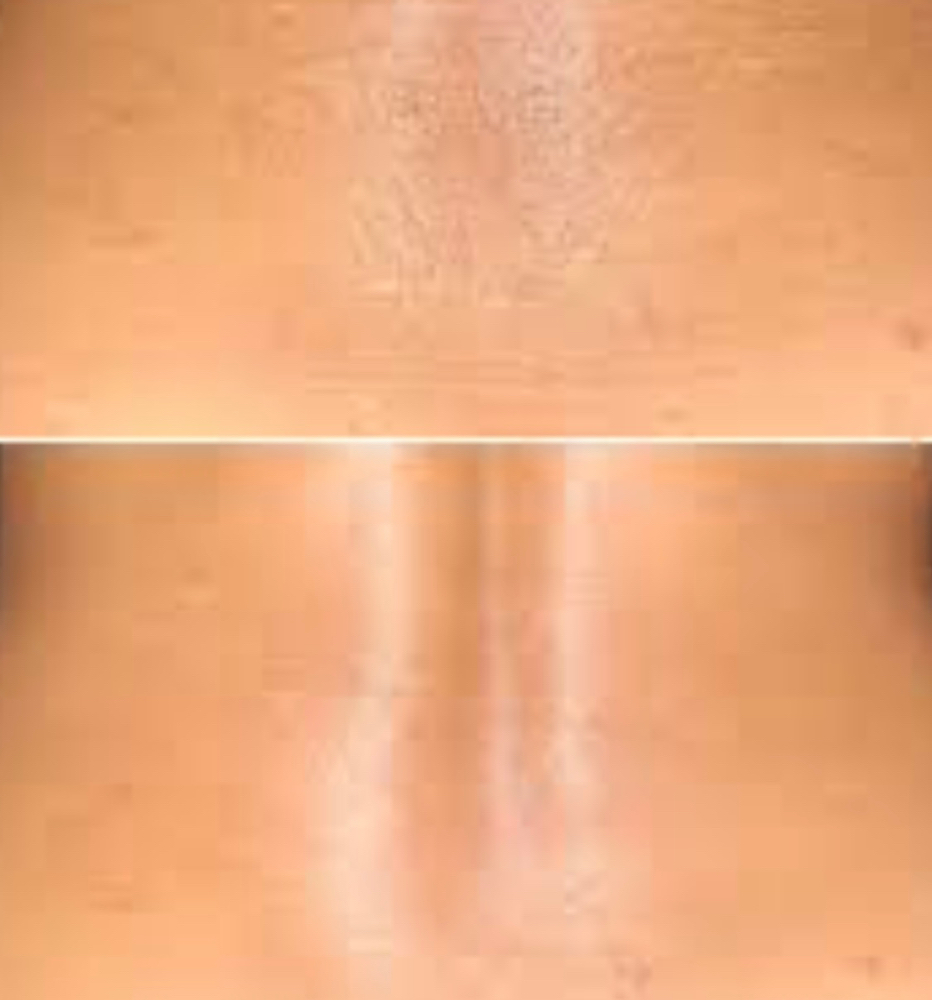 Lower Back at Coastal Beauty Spa in Riverview, FL