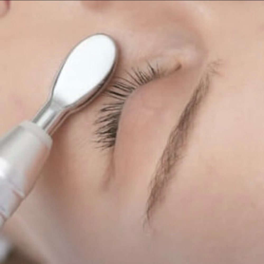 Eye Mesotherapy Treatment at Luxe Skin & Lash Studio in Tewksbury, MA