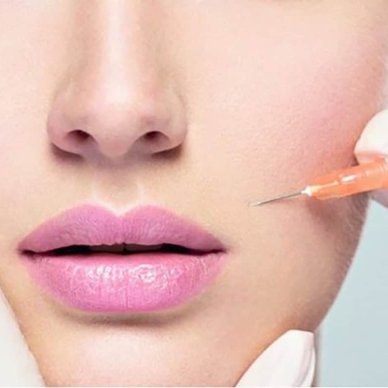 Dermal Fillers at Muy Bueno Injections by Pat MSN RN in San Antonio, TX