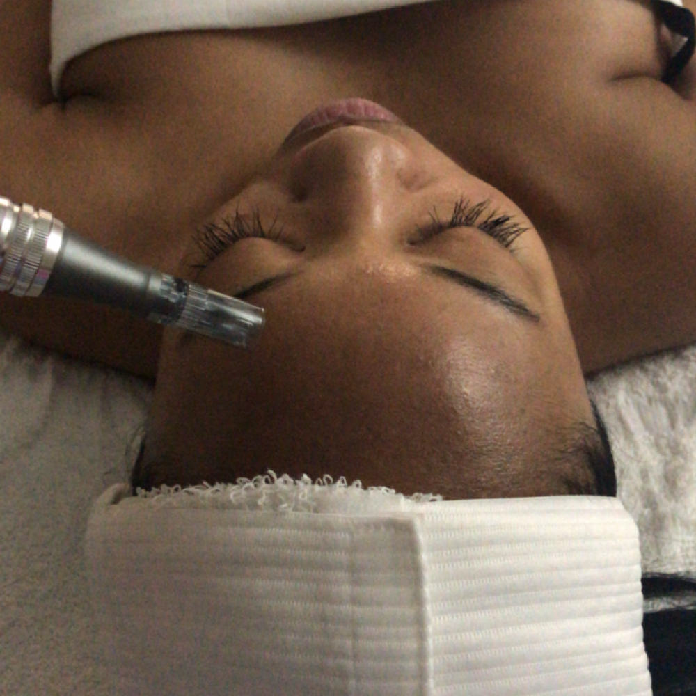 Microneedling at Plush Luxe Aesthetic Lounge & Skin Clinic in Madison, TN