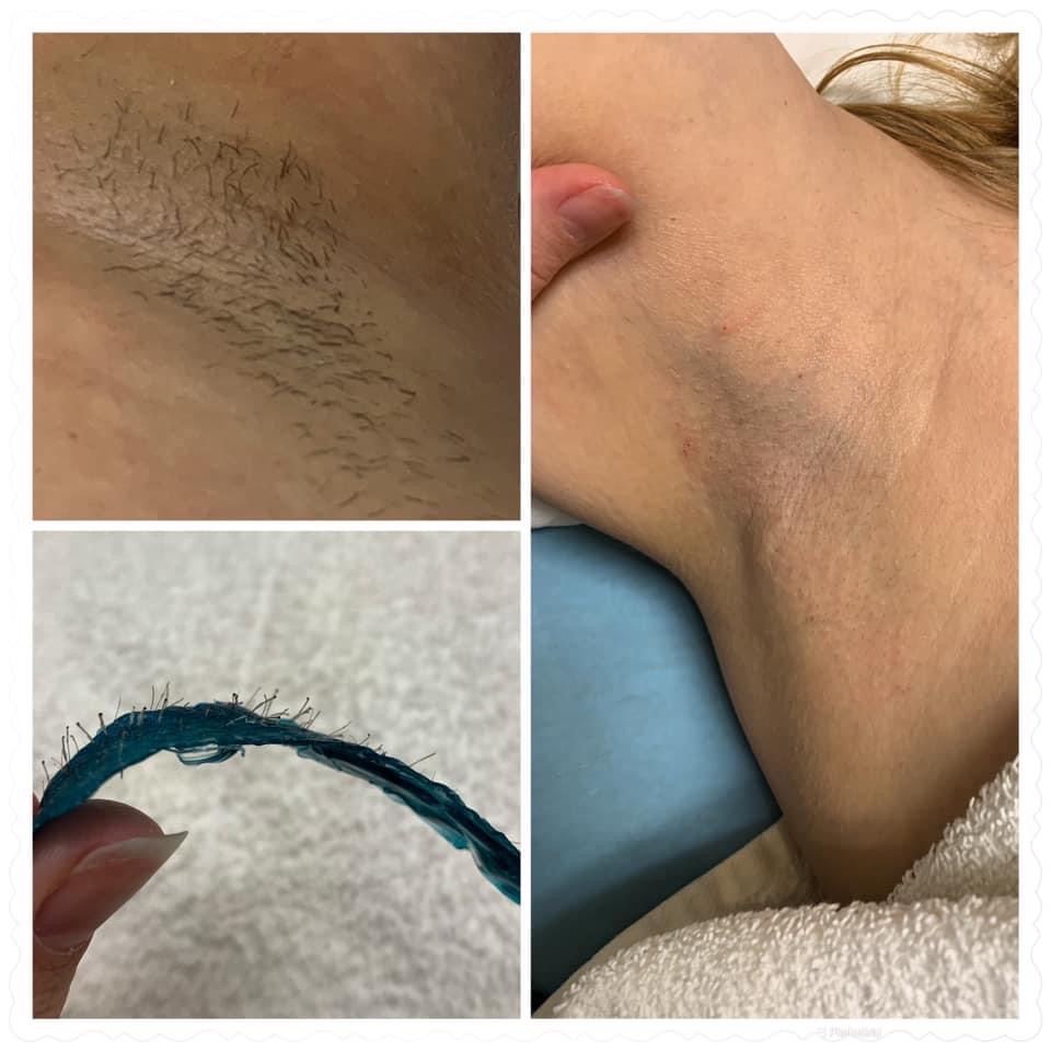 Underarm Wax
