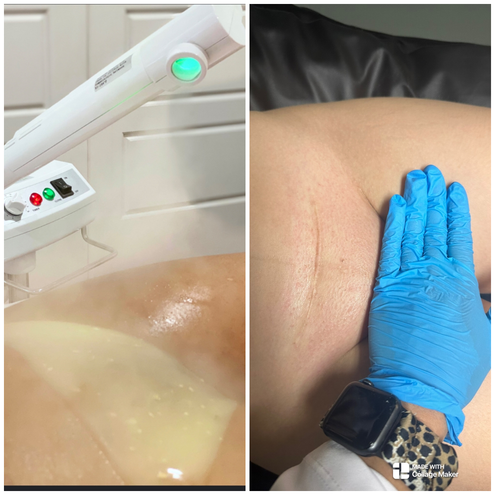 Brazilian Wax And Vajacial