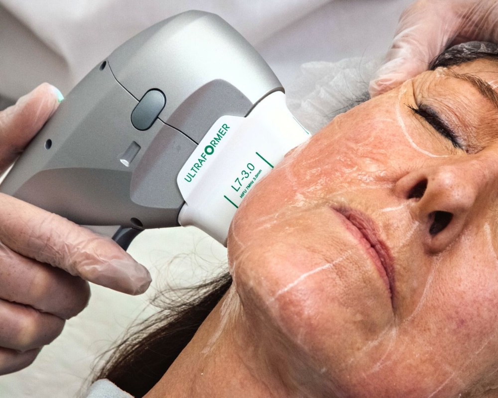HiFu Facelift