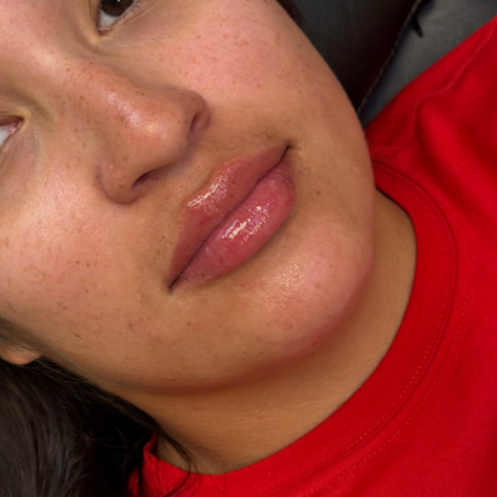 Half Syringe Lip Filler at Omni Beauty Bar in Houston, TX
