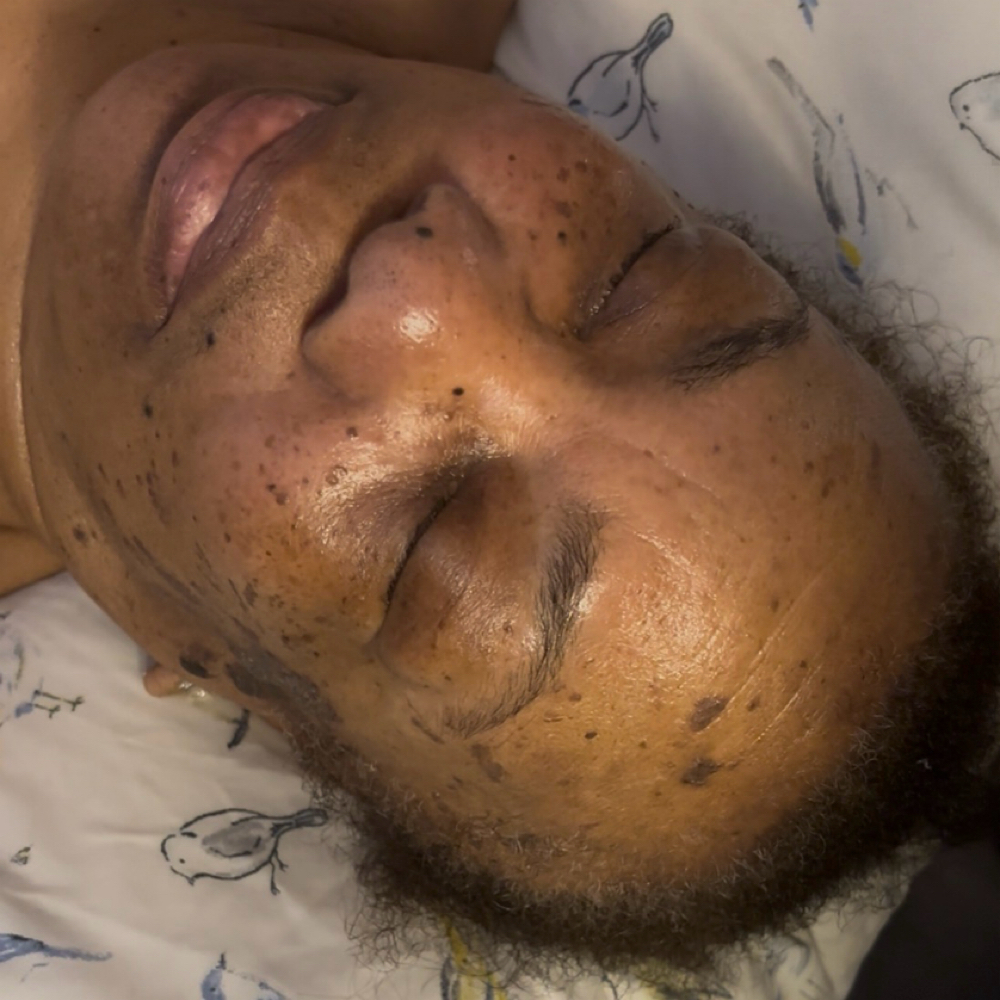Fix My Skin at Kinetic Aura in Redford, MI