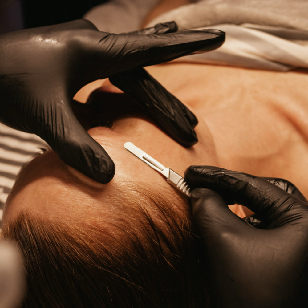 Add Ons - Dermaplaning at Holistic Skin and Massage Factory in Tucson, AZ