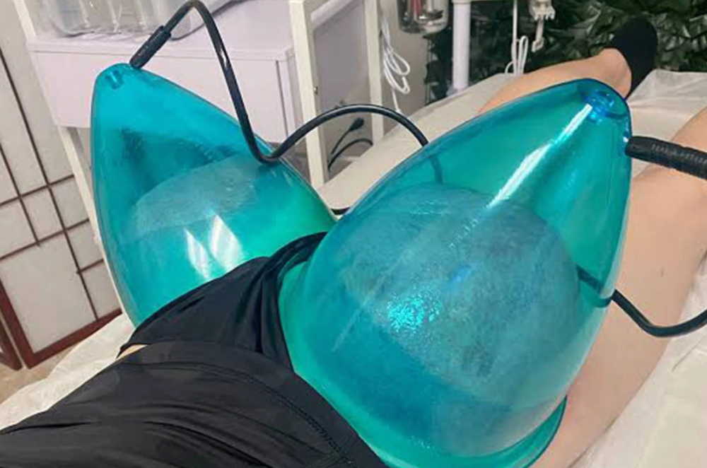 Non-Invasive Buttock Therapy (BBL)