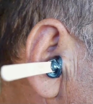 Ear Wax