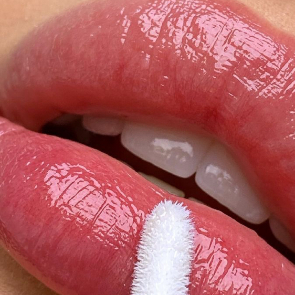 1ML LIP FILLER REGULAR NEEDLE at Kimspa&beauty in Dallas, TX