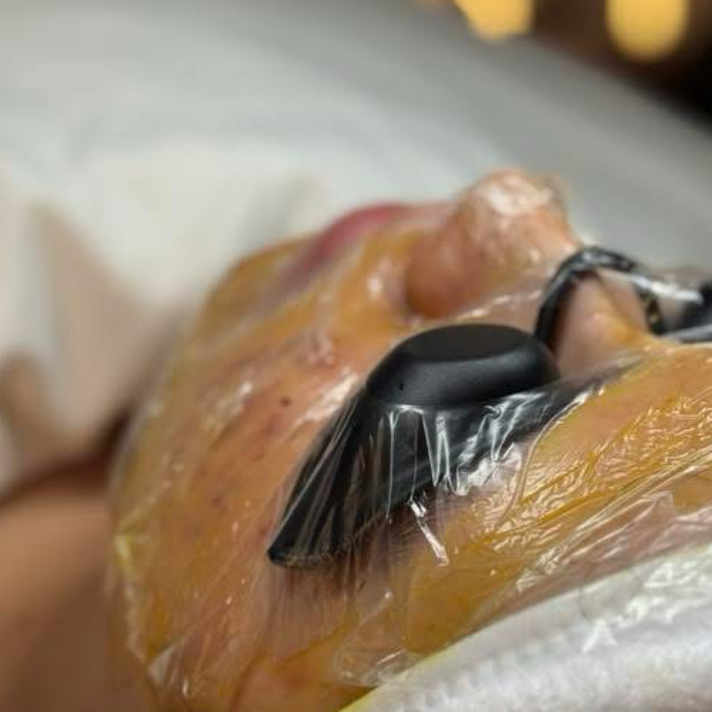 K- Acne Healing Facials at Caza Seoul in Lakewood, CO