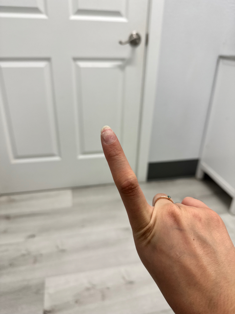 Nail Fix