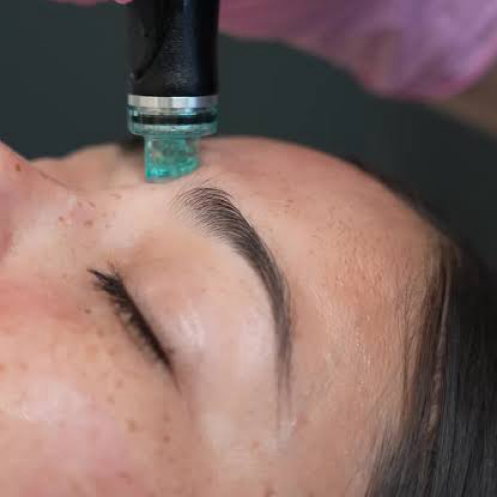 Aqua Facial Limited Time Offer at Esthetics Love in Akron, OH