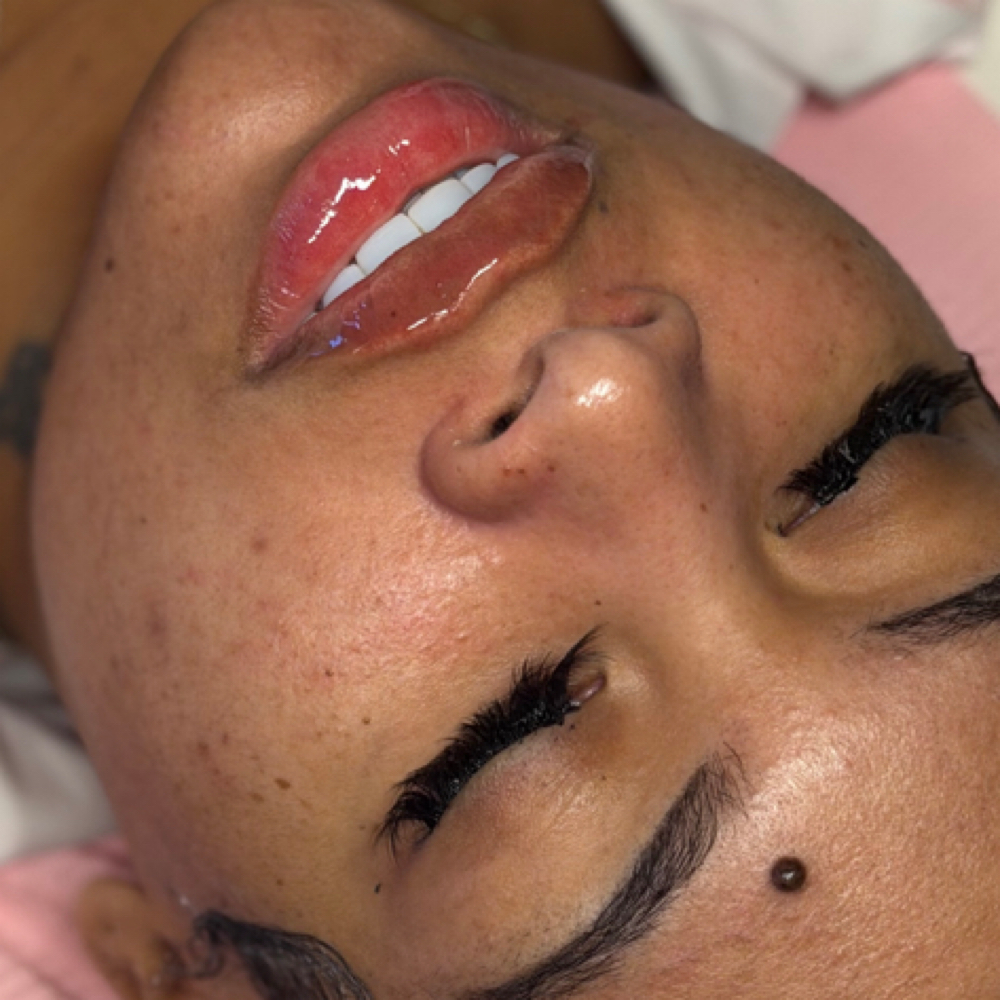 **April Special $135 Filler *** at Maurika Beauty in Jacksonville, FL