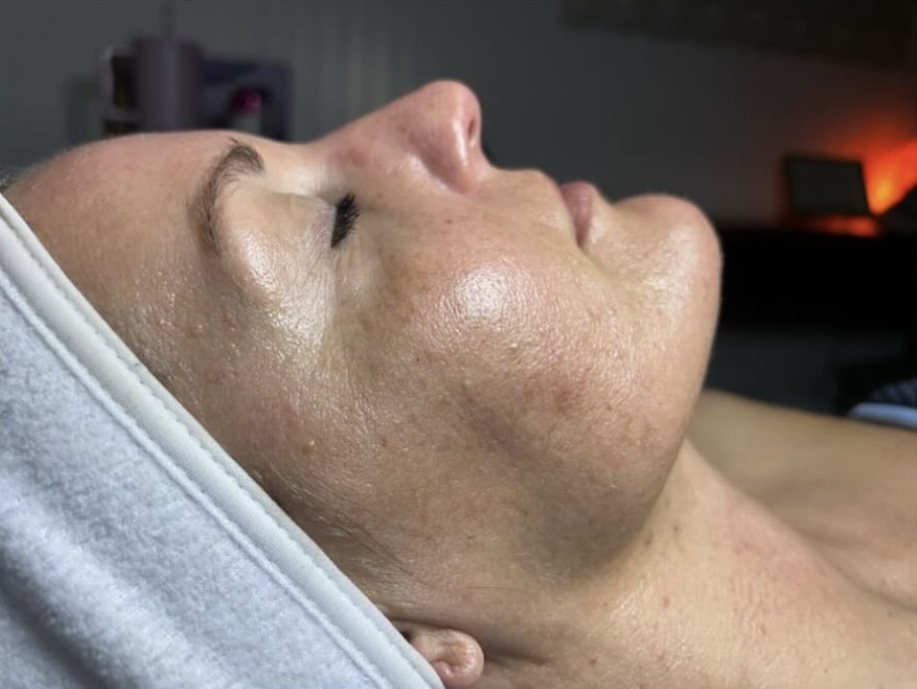Nano Infusion Facial