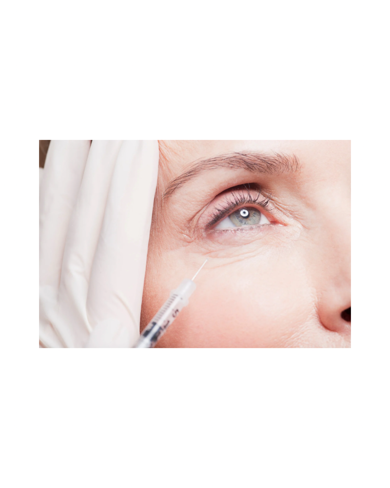 PRP Under Eye /dark circle