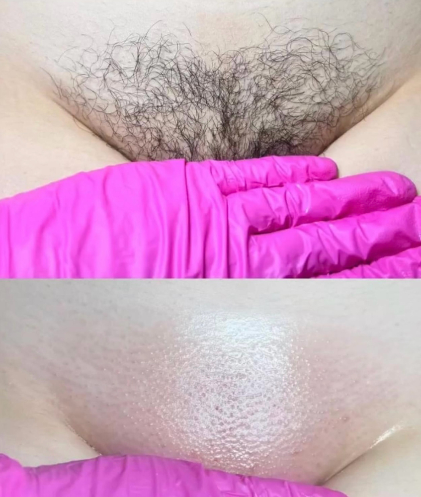 Brazilian Wax
