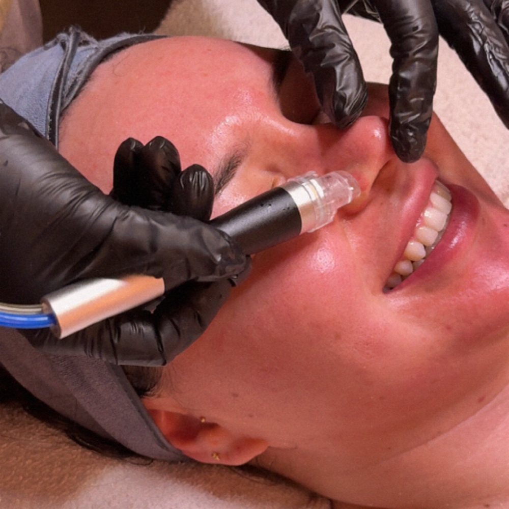 Hydro Glaze at Skinly Beauty in Bakersfield, CA